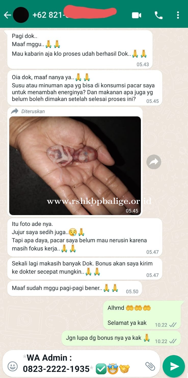 Klinik _ Apotik Solusi Menggugurkan Kehamilan | Jual Obat Aborsi Asli di Pati ( Wa 083146666109 )