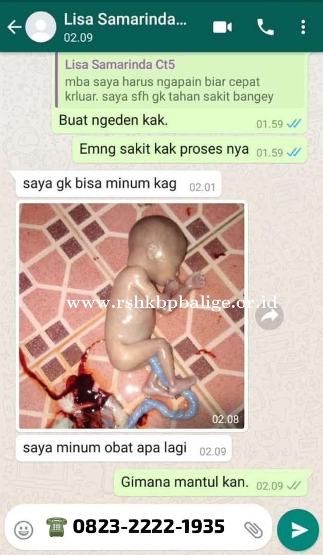 Klinik _Apotik Solusi Menggugurkan Kehamilan | Jual Obat Aborsi Asli di Tembalang ( Wa 083146666109